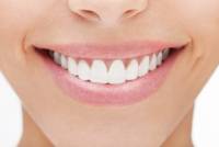 smiling-woman-white-teeth-300x200